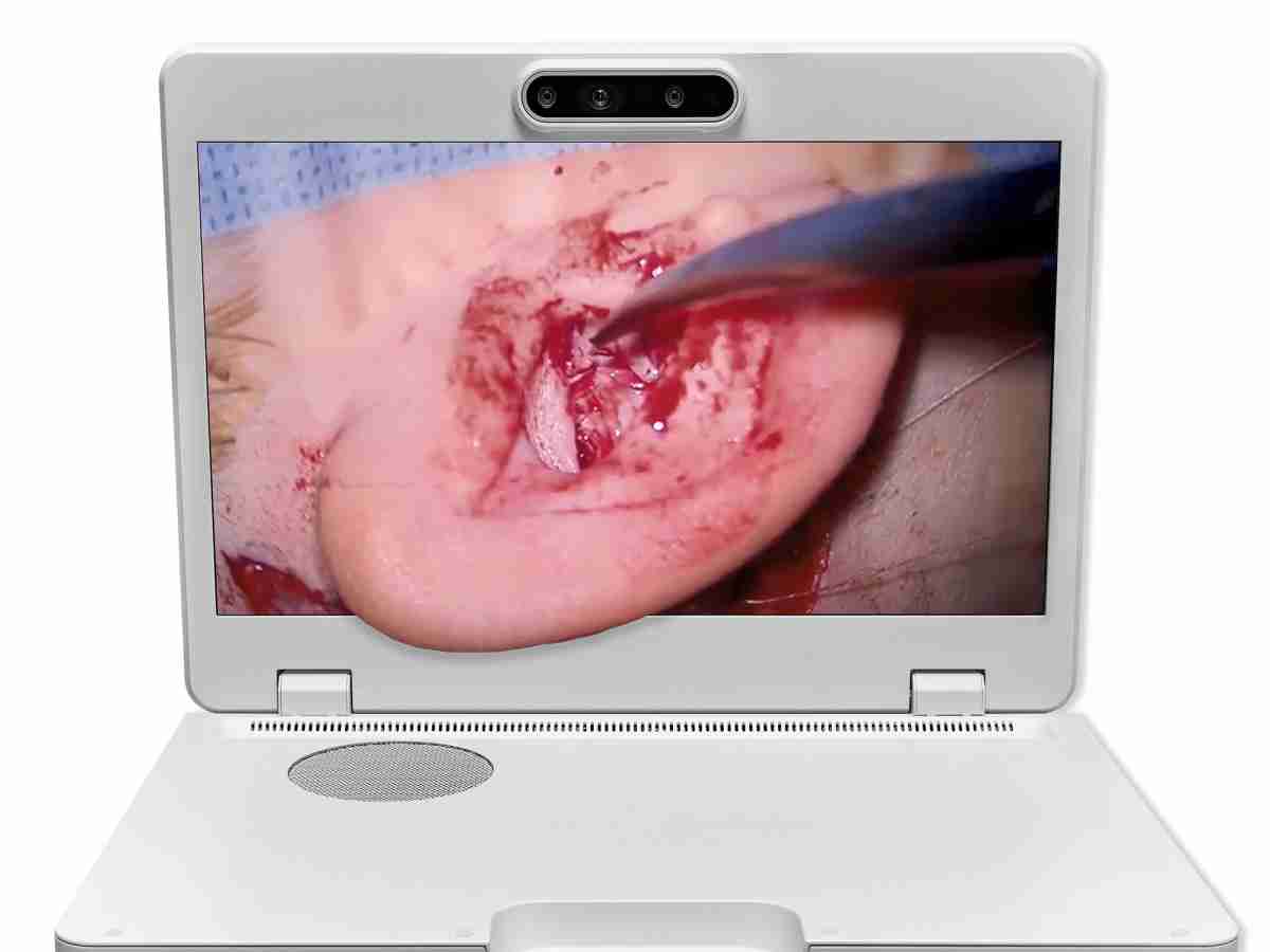 达擎之＂Heads-up 3D显微手术显示系统＂，，，整合4K裸眼3D显示及眼球追踪系统，，，具备快速追踪人眼移动位置功能，，，减轻医师长时间维持固定姿势的负担，，，，让医师能有更宽广清晰的3D立体视野及更舒适的姿势来执行手术。。。。